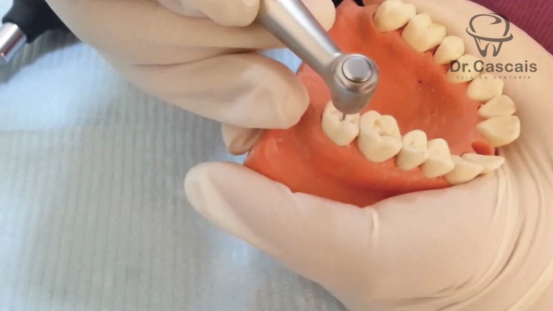 Dentisteria Operatória